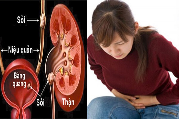 Xử lý nước nhiễm canxi