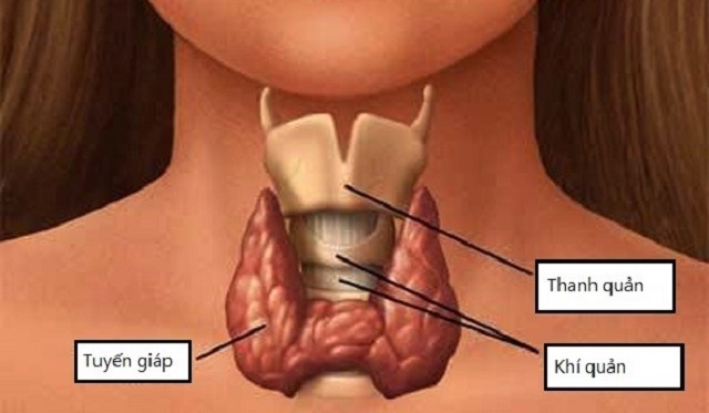 Ung thư tuyến giáp – căn bệnh đáng báo động trong thời gian vừa qua