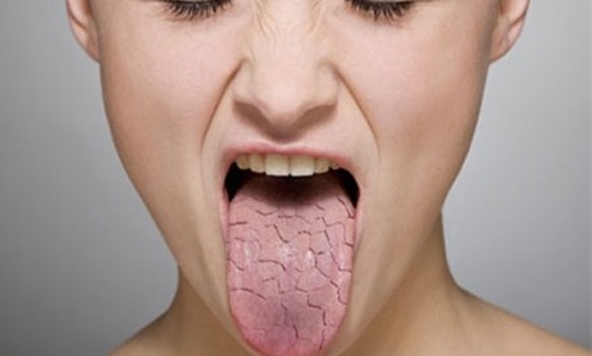 Uống ít nước hại như hút thuốc lá