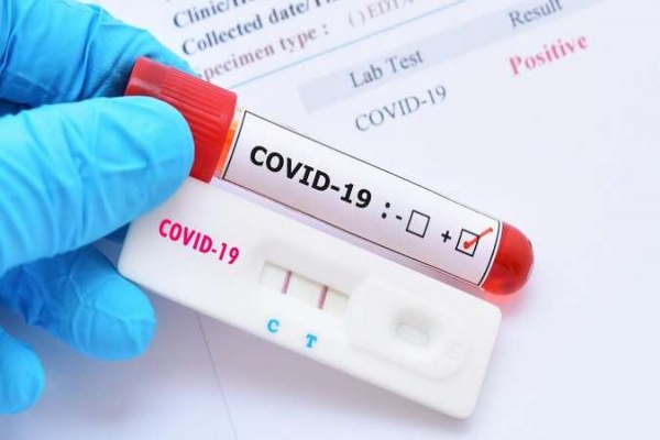 Hướng dẫn test nhanh Covid-19 tại nhà