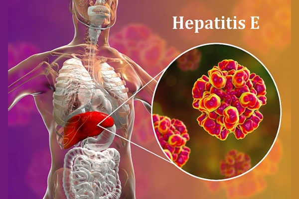 Virus viêm gan E lây lan do nước ô nhiễm